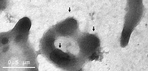 Mycoplasma pulmonis