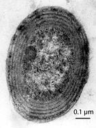 Picture of Prochlorococcus