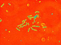 ADP1 cells