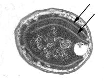 Electron micrograph of Synechococcus sp. WH7803