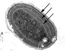 Electron micrograph of Synechococcus sp. WH7803