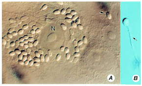 A host cell infected with Brachiola algerae