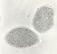 TEM image of Methylobacterium dichloromethanicum DM4
growing with dichloromethane