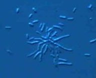 bradyrhizobium ORS278