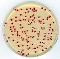 colonies of Bradyrhizobium ORS278
