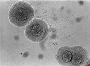 Mycoplasma hominis PG21