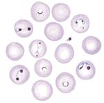 Babesia