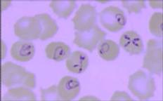 Babesia microti infecting human
erythrocytes