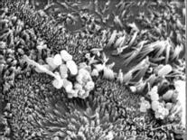 Interaction
between human colon cells in culture and proprionic dairy
bacteria