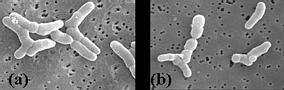Morphology of Propionibacterium freudenreichii
