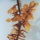 Casuarinaceae multilobed nodule