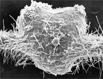 Young <em>Alnus glutinosa</em> nodule at the three lobe step