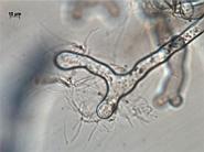 <em>Alnus glutinosa</em> root hairs 14 days after infection by <em>Frankia alni</em>.