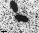 Transmission electron
micrograph of <em>Azospirillum lipoferum</em>