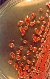 colonies of R. solanacearum on a Petri dish