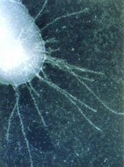 Micrography of R. solanacearum