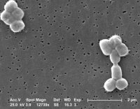 Electron micrograph of Acinetobacter baumannii
