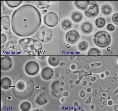 Photo of <i>Blastocystis hominis</i>)