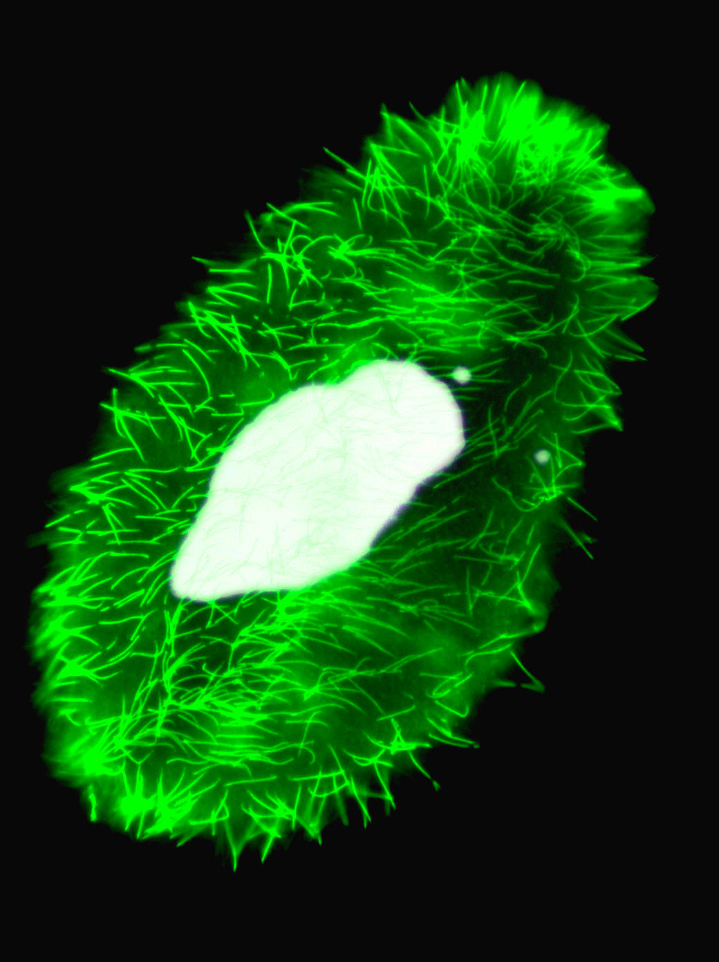 Paramecium tetraurelia (photo J. Beisson)