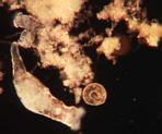 Bacteria