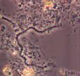 Bacteria